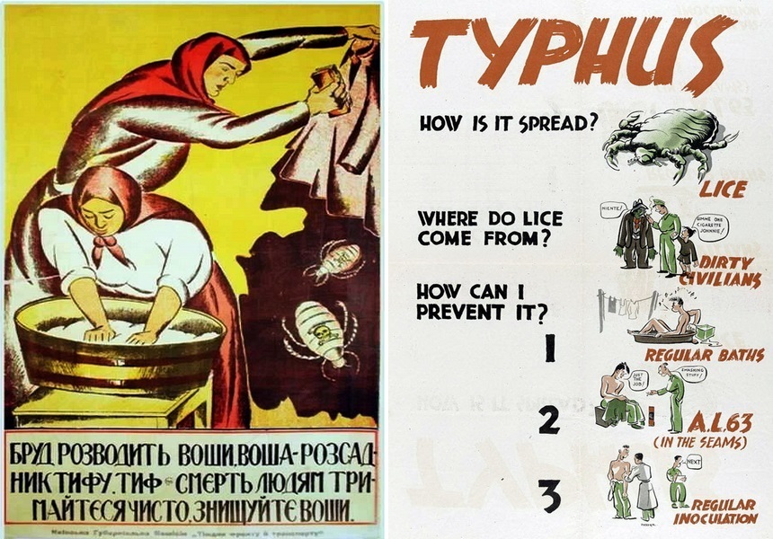 ​On the left, Soviet poster in Ukrainian, published in 1919 – 1920 in Kyiv:“ Lice live in the mud, lice carry typhus that is sure death. Keep yourself clean and prevent lice from spreading”. On the right, the British World War II poster:” How is it spread? Lice. Were do lice come from?” - Highlights for Warspot: eternal companions of soldiers | Warspot.net